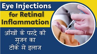 All about Eye Injections for Retina  Eye Cancer injection  आँखों के परदे की सूजन का टीके से इलाज [upl. by Cacilia149]