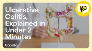 Ulcerative Colitis Explained in Under 2 Minutes  GoodRx [upl. by Wiltshire]