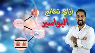 افضل علاج للبواسير [upl. by Nnylhtak380]