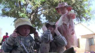 Protect the rights of people with albinism [upl. by Wat161]