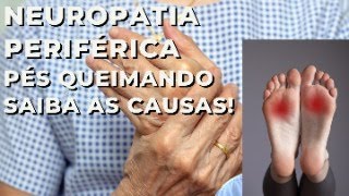 Neuropatia periférica Pés e mãos queimando Saiba a causa [upl. by Nawuq]