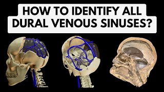 Dural venous sinuses  Identification in a 3D Model amp Cadaveric Specimen  Head Neck Anatomy [upl. by Uel]