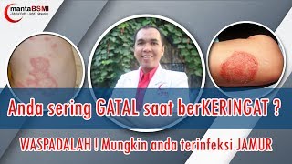 Gatal selangkangan  GATAL saat berKERINGAT  Kulit anda JAMURAN [upl. by Ihcur]