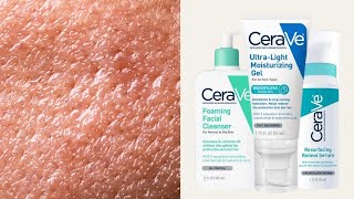 Top 5 CeraVe Skincare for Oily  Combination Skin Types [upl. by Syman]