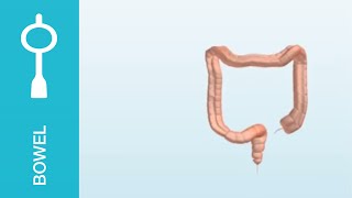 Peristeen  scintographics showing the bowel before and after Peristeen use [upl. by Nived727]