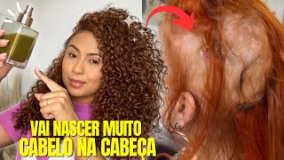 🚨CABELO CRESCE EM 10 DIAS  CRESCIMENTO ACELERADO COM APENAS 2 INGREDIENTES hair transformation 🔥 [upl. by Eked]