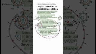 Impact of HAART on anesthesia  sedation [upl. by Adlai585]