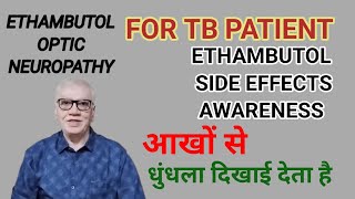 टीबी की दवा और आखो से कम दिखाई देनाETHAMBUTOL TOXICITY SIDE EFFECTS OF ETHAMBUTOL [upl. by Jonme]