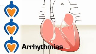 Arrhythmia overview  Types  Diagnosis and treatment [upl. by Nnagrom]