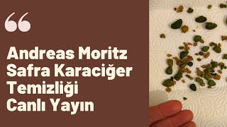 Andreas Moritz Safra Karaciğer Temizliği Canlı Yayın Benden çıkan taşlar [upl. by Mirilla]