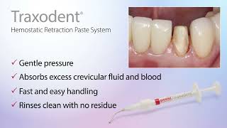 Traxodent® Hemostatic Retraction Paste System  Ideal for Digital Impressions [upl. by Razatlab950]