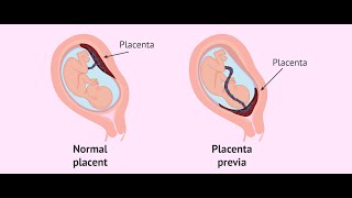 Placenta development part 1general embryologyشرح بالعربي [upl. by Suiravad]