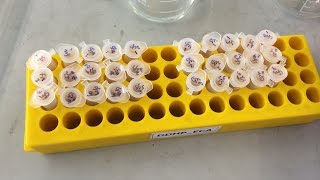 VLog  Alpha Glucosidase Inhibition Assay Documentary VLOG [upl. by Joellyn966]