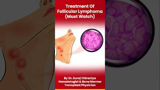 Treatment Options for Follicular Lymphoma by DrSurajChiraniyaHematologist rituximab lymphoma [upl. by Cassil]