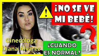 ⚠SACO GESTACIONAL SIN BEBÉ❗ ¿Hasta cuando es NORMAL❓ por GINECOLOGA DIANA ALVAREZ [upl. by Margarethe167]