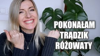 POKONAŁAM TRĄDZIK RÓŻOWATY│Moja aktualna pielęgnacja│Semika [upl. by Whatley]