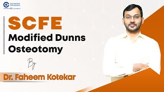 SCFE Modified Dunns Osteotomy by DrFaheem Kotekar ConceptualOrthopedics [upl. by Fabian204]