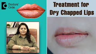 GET RID OF HYPERPIGMENTATION AROUND THE MOUTH DR DRAY [upl. by Eladnor375]