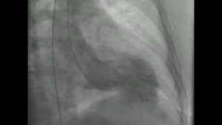 LVGRAM DA [upl. by Fellows418]