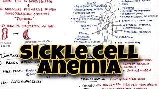 Sickle cell anemia in hindi  Anemia part2  Eduluminescence [upl. by Aidne]