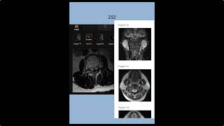 RADIOLOGY EXAM CASES [upl. by Christoph]