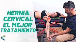 Como tratar una HERNIA DISCAL 🤩 cervical 👉 ejercicios  masaje  diatermia VOSSMAN Fisiolution [upl. by Reniar]