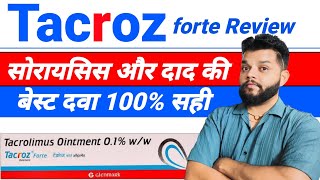 Tacroz Forte Ointment Review  Tacrolimus Ointment Uses Mode Of Action amp Side Effects In Hindi [upl. by Ardnikat731]