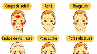 6 Masques du Visage Pour Améliorer ta Peau [upl. by Langer]