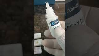 HIV HCV HBSAG Test Procedure by Kit laboratory pathology medicallaboratory lab labtechdt [upl. by Eidaj123]