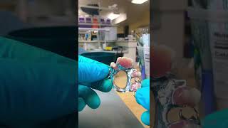 Please subscribe orthodontist orthodontics advancedorthodontics satisfying simple [upl. by Glenden822]