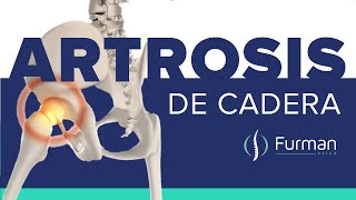 ARTROSIS DE CADERA 😡 dolor de cadera  tratamientos naturales osteoartritis de cadera [upl. by Delogu]