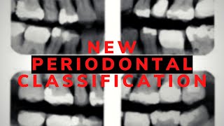 New Periodontal Classification [upl. by Koressa22]