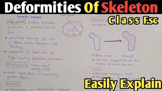 Deformities Of Skeleton  Arthritis  Osteoporosis  Herniation  Class 12 [upl. by Assenab]