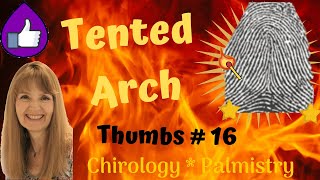 Tented arch dermatoglyphic on thumb tip  Chirology  Palm Reading [upl. by Nylatsyrc119]