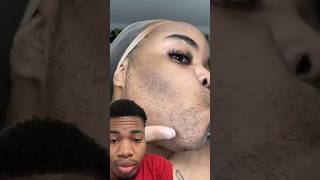 Lady shaves off her BEARD 🧔🏽 [upl. by Ecinom]