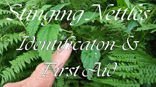 Stinging Nettles Identification and First Aid [upl. by Ardnael147]