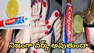 I Tried Popular DIY Feet Whitening Methods [upl. by Cuda]