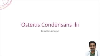 Osteitis Condensans Ilii  DrKathir Azhagan orthomechanic [upl. by Fay483]