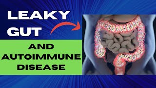 Foods for Healing Leaky Gut for People over 50 [upl. by Ritch]