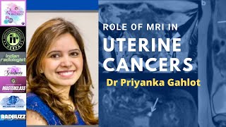 ROLE OF MRI IN ENDOMETRIAL CANCER  DR PRIYANKA GAHLOT [upl. by Janeta]