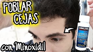 Minoxidil para POBLAR las CEJAS ¡Como Aplicarlo CORRECTAMENTE [upl. by Euqinomad982]