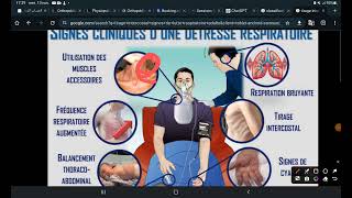 UE1 Sémiologie respiratoire  Les Signes fonctionnels Part 1 La Dyspnée [upl. by Suivatnom]