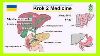 Krok 2 Medicine  Year 2019  123 Ministry of Public Health of Ukraine [upl. by Aitercul]