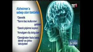 Alzheimer nedir nasıl oluşur ve daha fazlası  Prof Dr Serdar Dağ [upl. by Tristram]