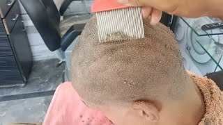 hair removal head shaving [upl. by Gem]