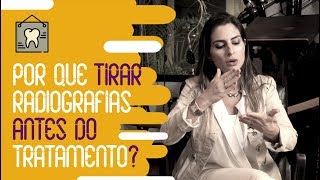 Documentação ortodôntica qual a importância desta fase do tratamento [upl. by Soigroeg636]