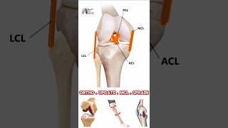 Management and Treatment of MCL Sprains in Adults medical animation 3d short [upl. by Rollet846]