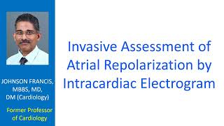 Invasive Assessment of Atrial Repolarization by Intracardiac Electrogram [upl. by Seena]