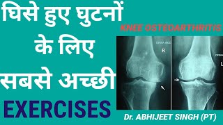 KNEE ARTHRITIS PAIN EXERCISES HINDI  KNEE PAIN EXERCISES HINDI  KNEE OSTEOARTHRITIS PAIN RELIEF [upl. by Adnic649]