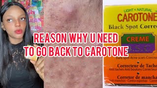 2023 BSC Face CreamGo Back To Using Carotone Black Spot Corrector facecream bodylotion [upl. by Nilved]